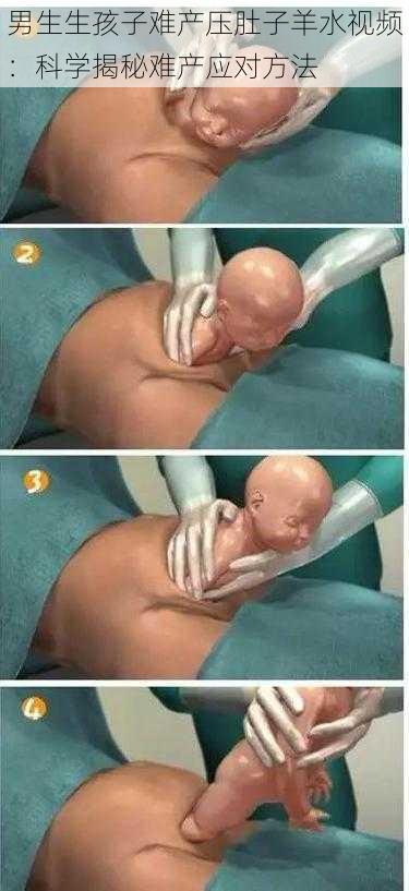 男生生孩子难产压肚子羊水视频:科学揭秘难产应对方法