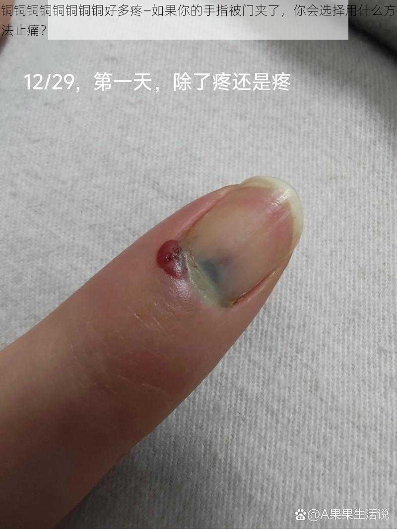铜铜铜铜铜铜铜铜好多疼—如果你的手指被门夹了,你会选择用什么方法止痛?