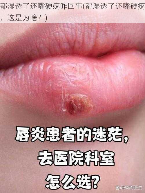都湿透了还嘴硬疼咋回事(都湿透了还嘴硬疼,这是为啥?)