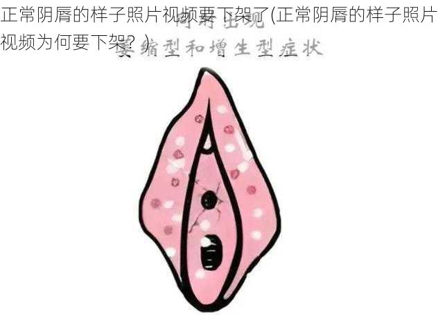 正常阴脣的样子照片视频要下架了(正常阴脣的样子照片视频为何要下架?)