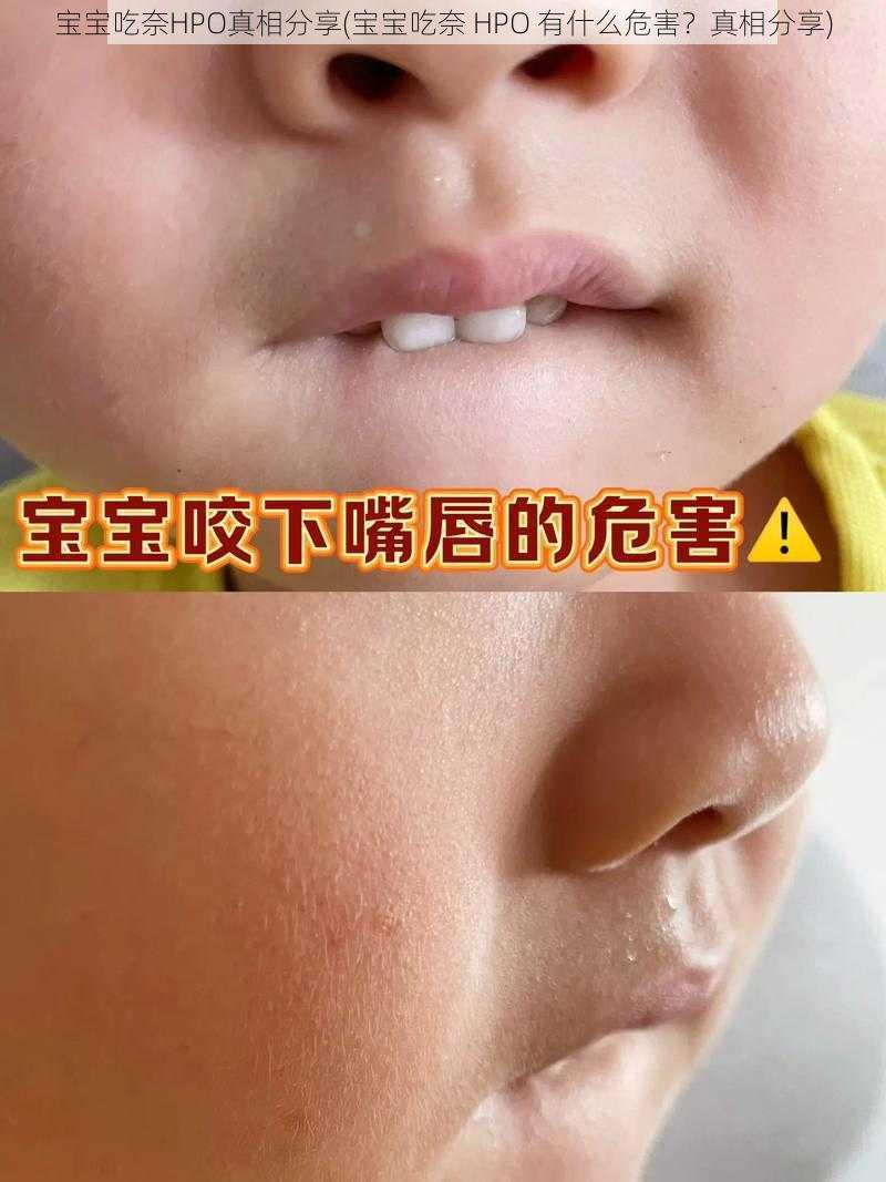 宝宝吃奈HPO真相分享(宝宝吃奈 HPO 有什么危害?真相分享)